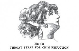 chin reduction