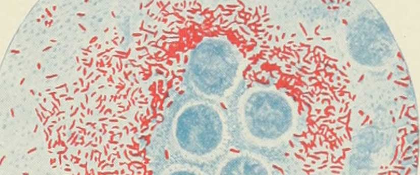 Amoeba with cholera vibrio and leprosy bacillus, as pictured in the Twelfth Annual Report of the Bureau of Science in Manila, courtesy of the Internet Archive.
